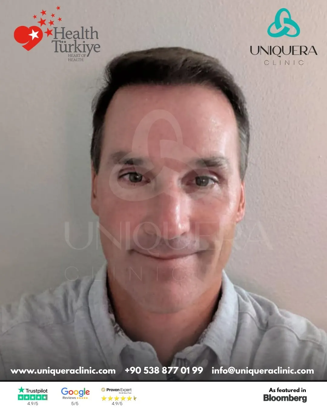 Sapphire FUE Hair Transplant in Turkey: What to Know Before You Book