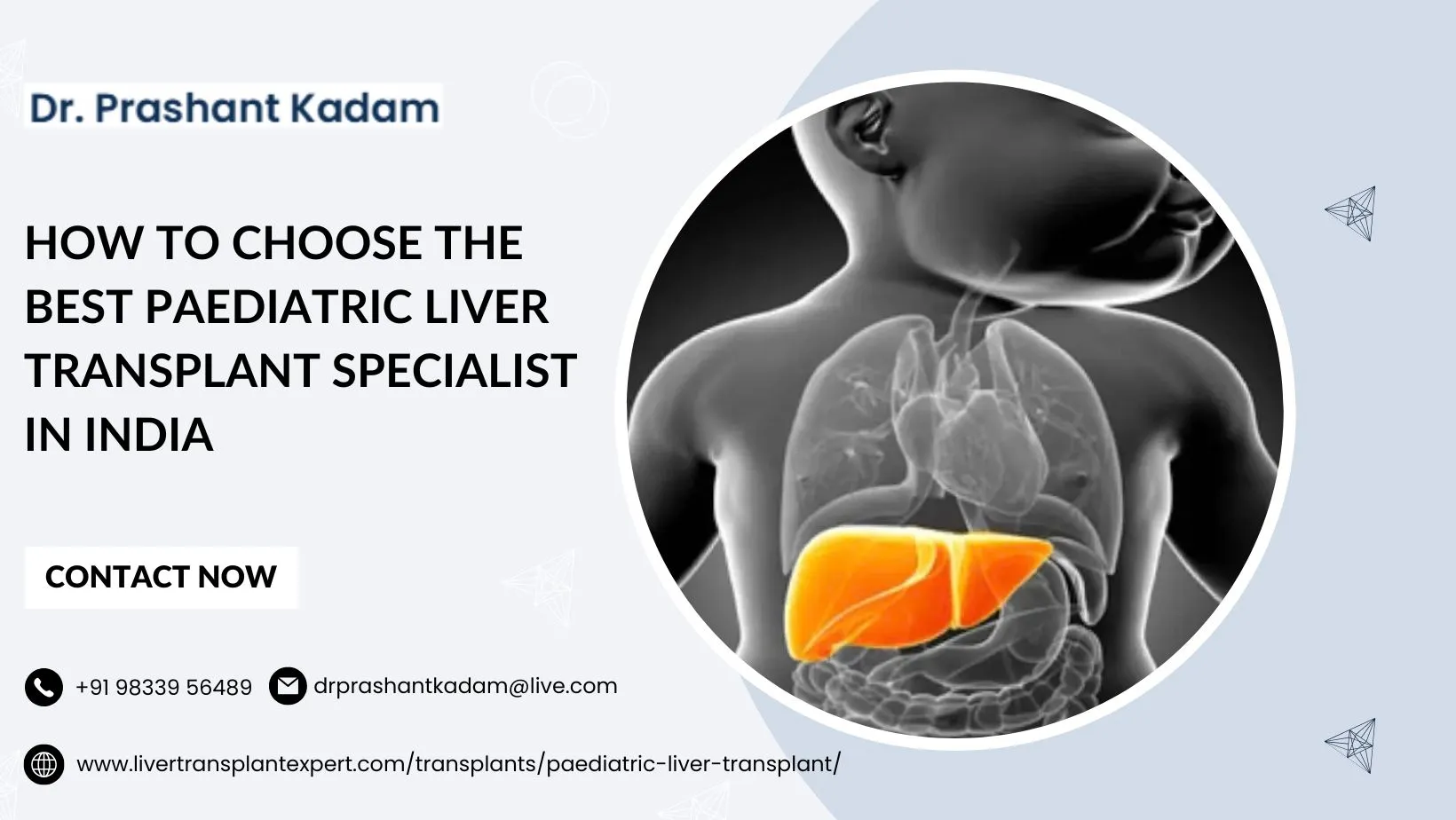 How to Choose the Best Paediatric Liver Transplant Specialist in India