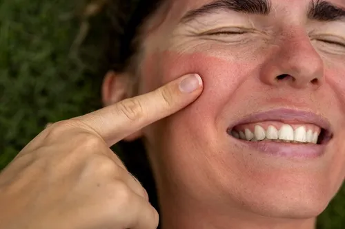 Sudden Summer Skin Rashes: When to See an Advanced Dermatologist in Venice, FL
