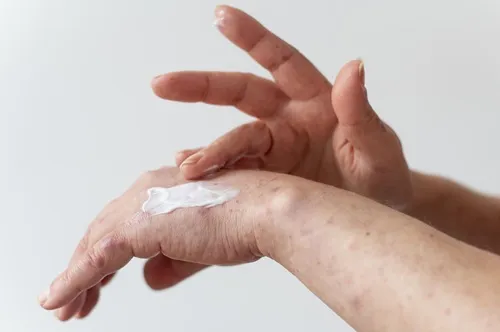Sudden Summer Skin Rashes: When to See an Advanced Dermatologist in Venice, FL