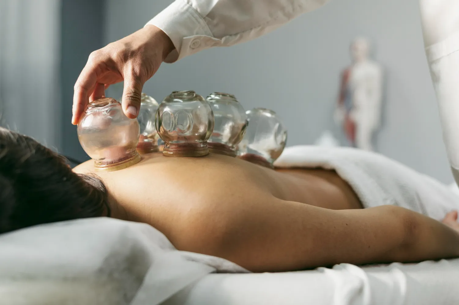 Where to Find Professional Cupping Therapy in London