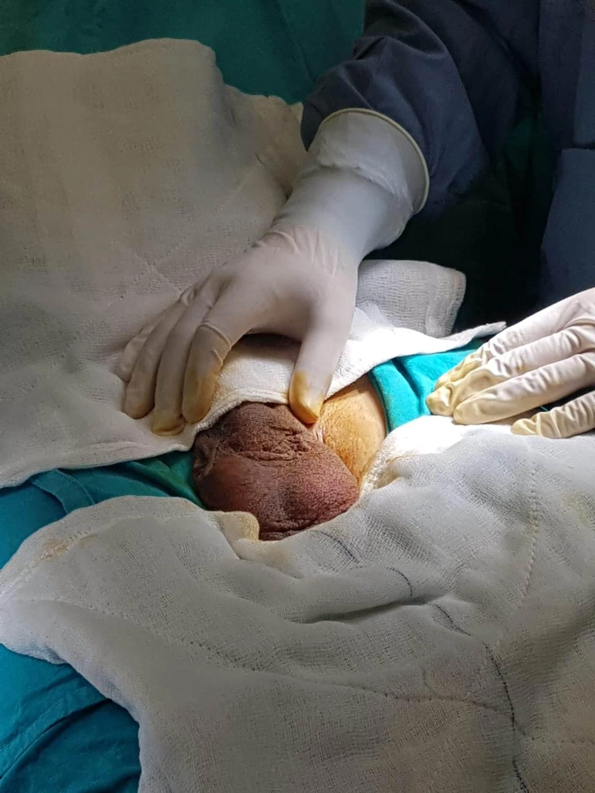 Best Dental Clinic In Bhopal