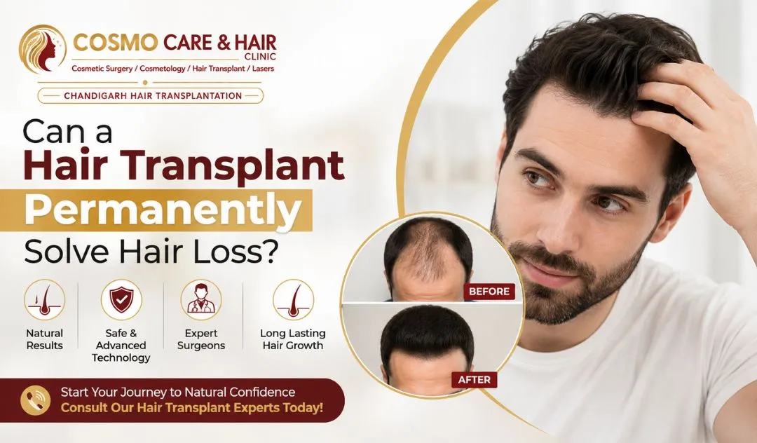 Can a Hair Transplant Permanently Solve Hair Loss?