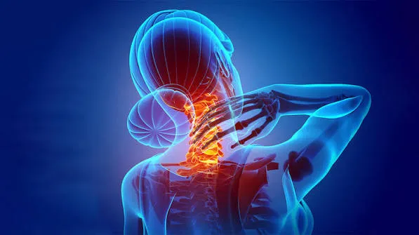 How to Recognize Occipital Neuralgia Symptoms and Treatment Guide