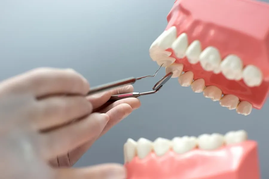 Benefits of Dental Crowns Scottsdale for Damaged Teeth