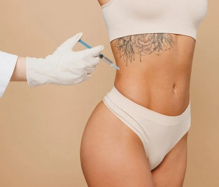 Fat Dissolving Treatment in Islington London – A Non-Surgical Solution for Stubborn Fat