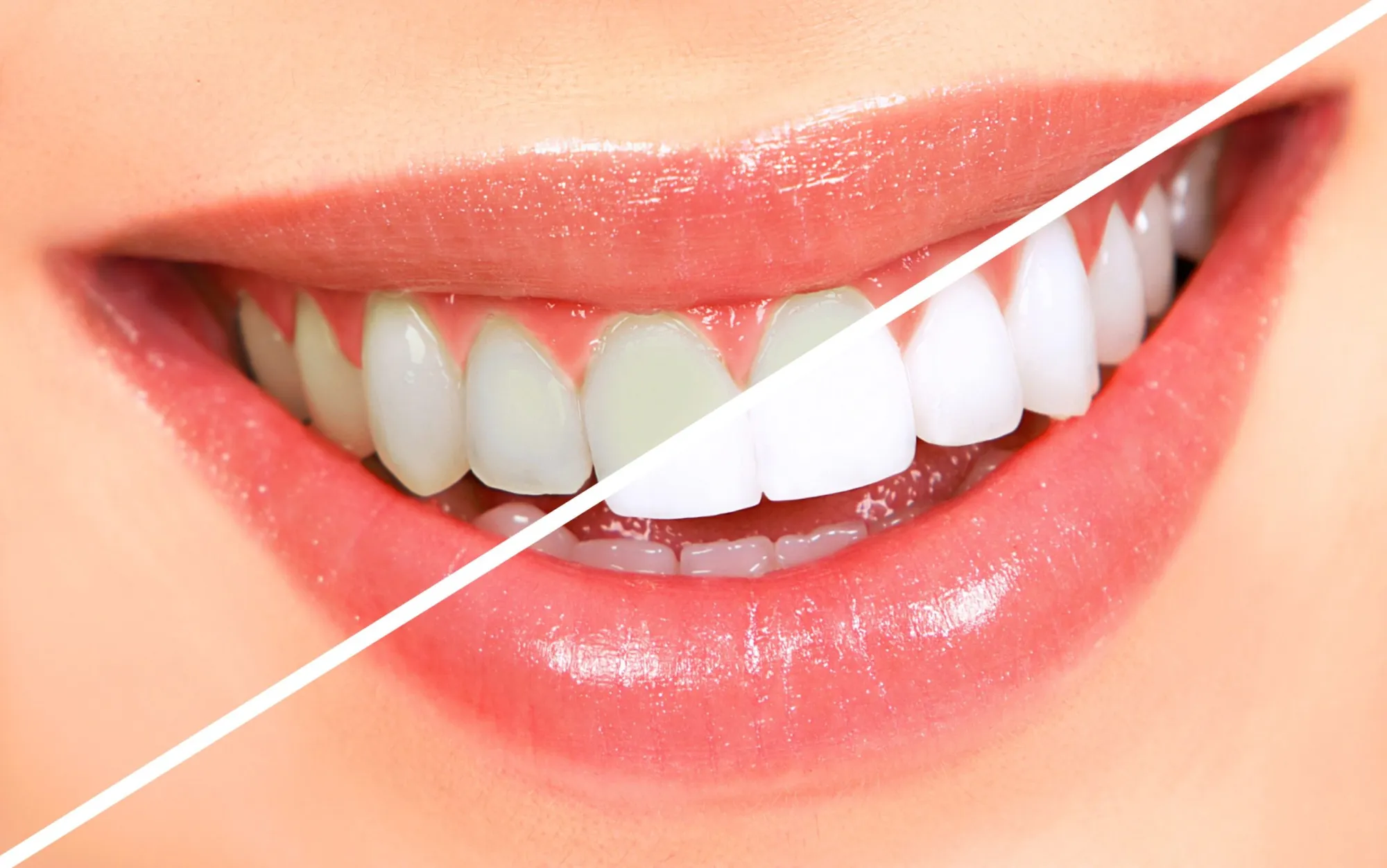 Dental Care: The Foundation of a Healthy and Beautiful Smile