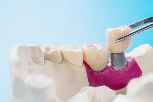 How Dental Bridges Union City Restore Your Smile