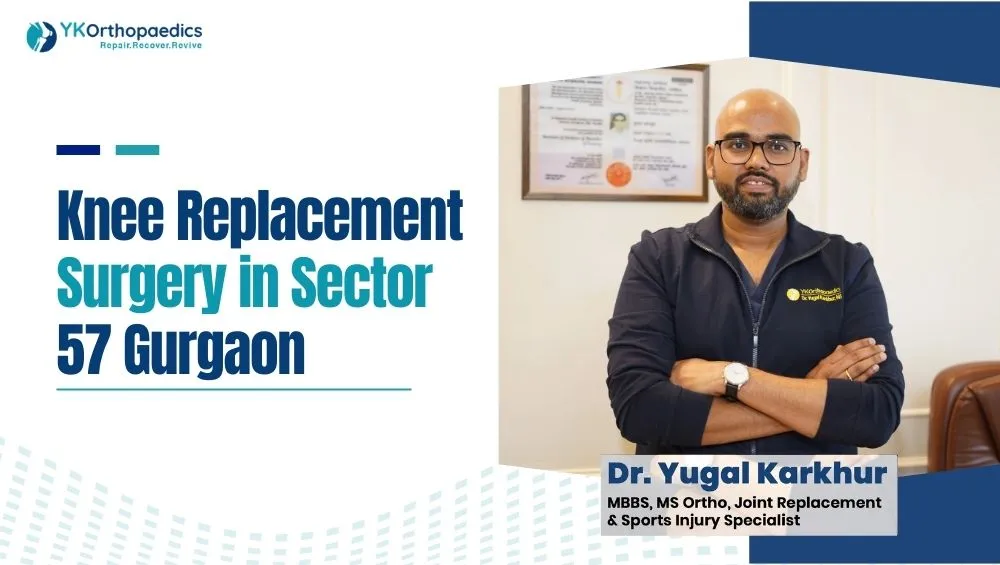 Knee Replacement Surgery in Sector 57 Gurgaon