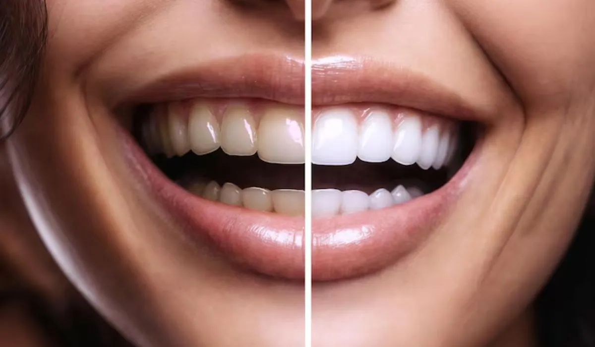 Cosmetic Dentistry Trends Burbank Patients Are Choosing