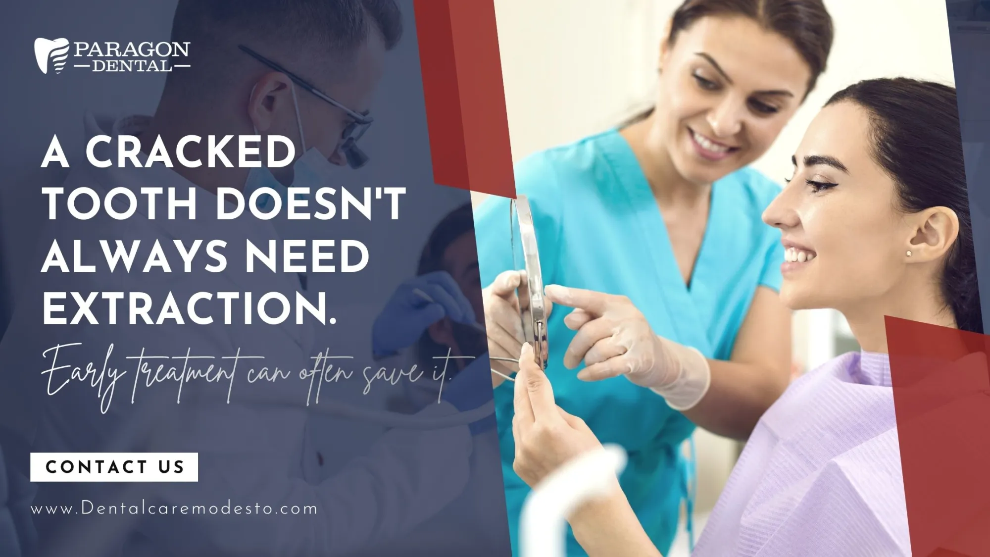 Can a Cracked Tooth Be Saved? When Root Canal Therapy in Modesto May Be the Best Option