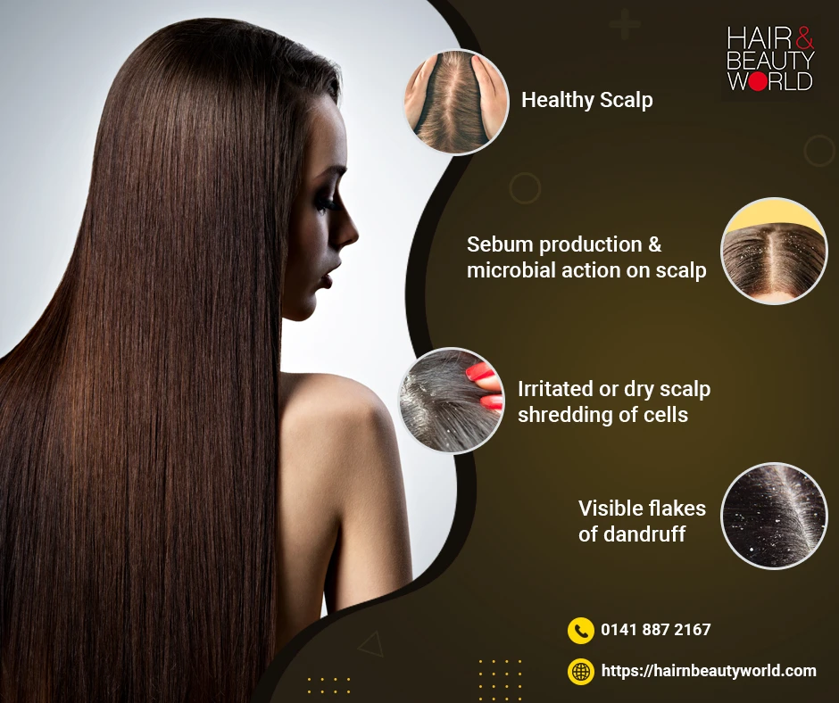 How Do You Treat &amp; Reduce Dry Scalp Problems?
