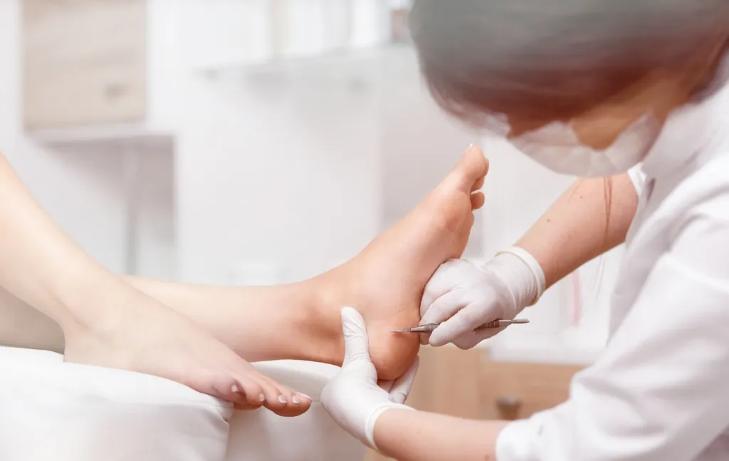 Symptoms and Diagnosis of Fungal Toenails in Calgary Patients