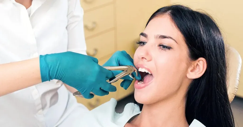Everything You Need to Know About Wisdom Teeth Extraction