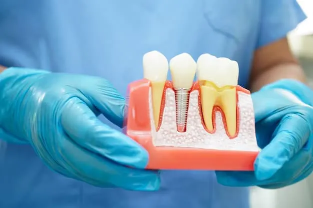 Why Dental Implants Are the Best Tooth Replacement Solution