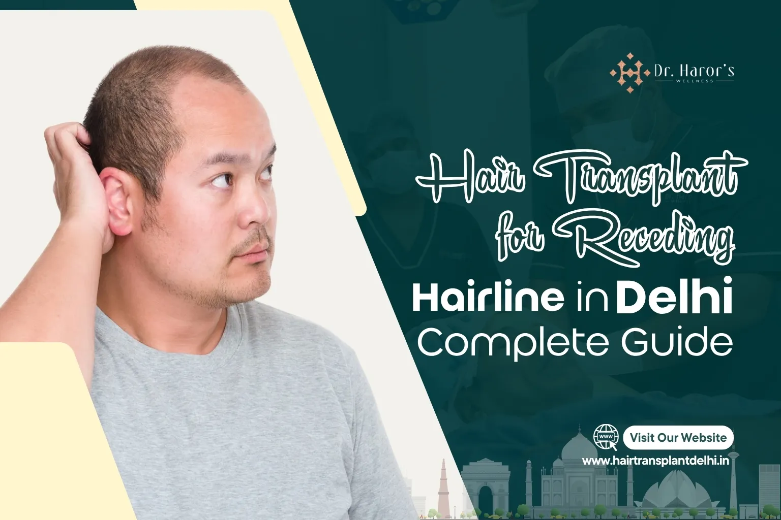 Hair Transplant for Receding Hairline in Delhi: Complete Guide
