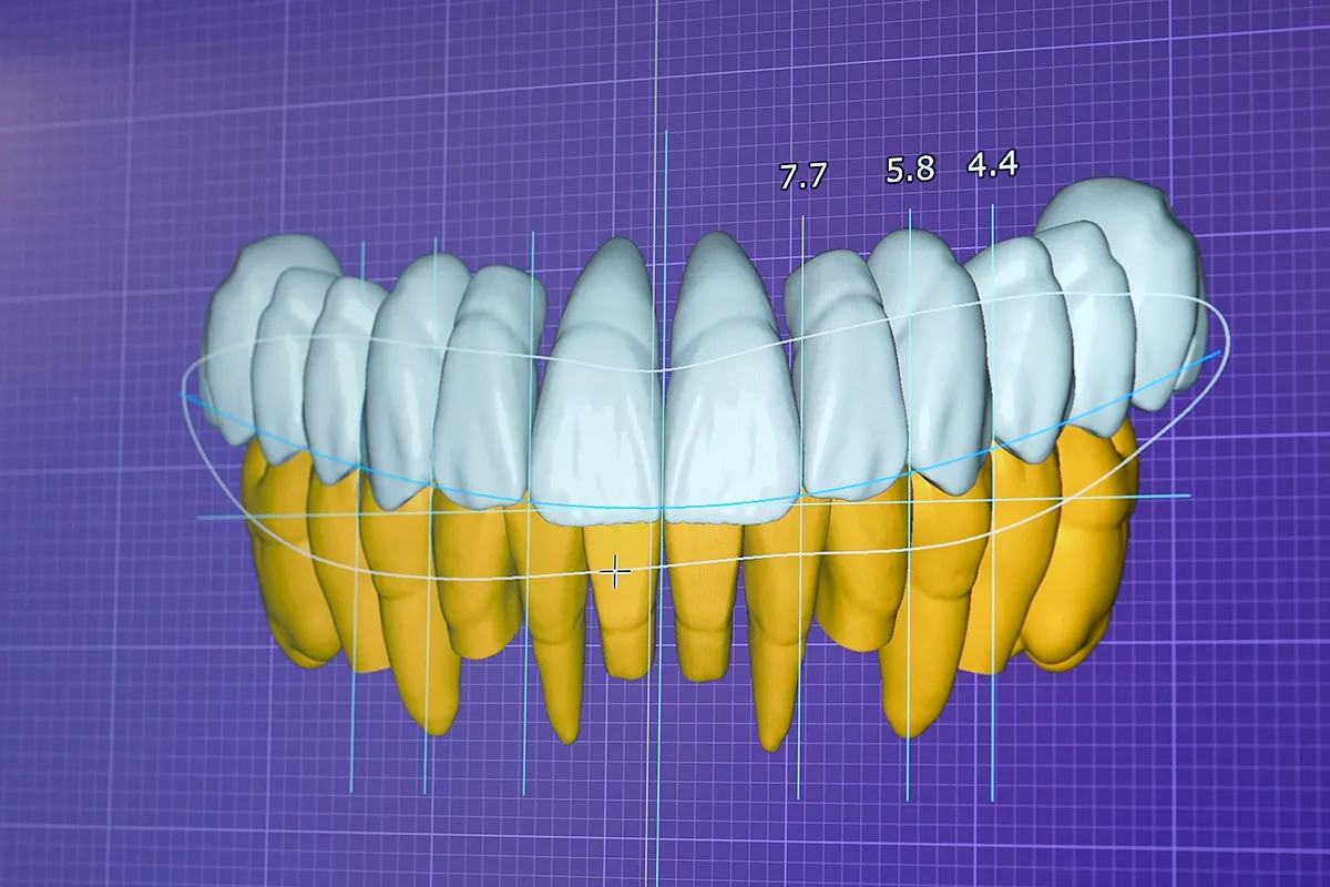 Top Cosmetic Dentistry Trends in 2026: What’s Changing and Why