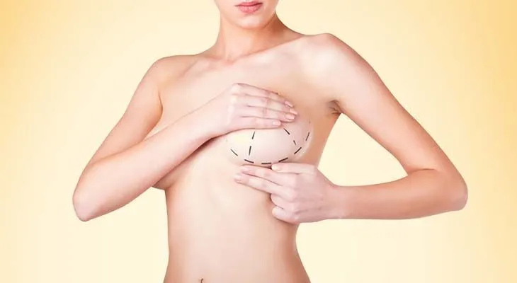 Breast Reduction in Dubai: Myths vs Facts You Should Know