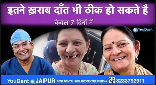 Smile Designing Treatment in Jaipur