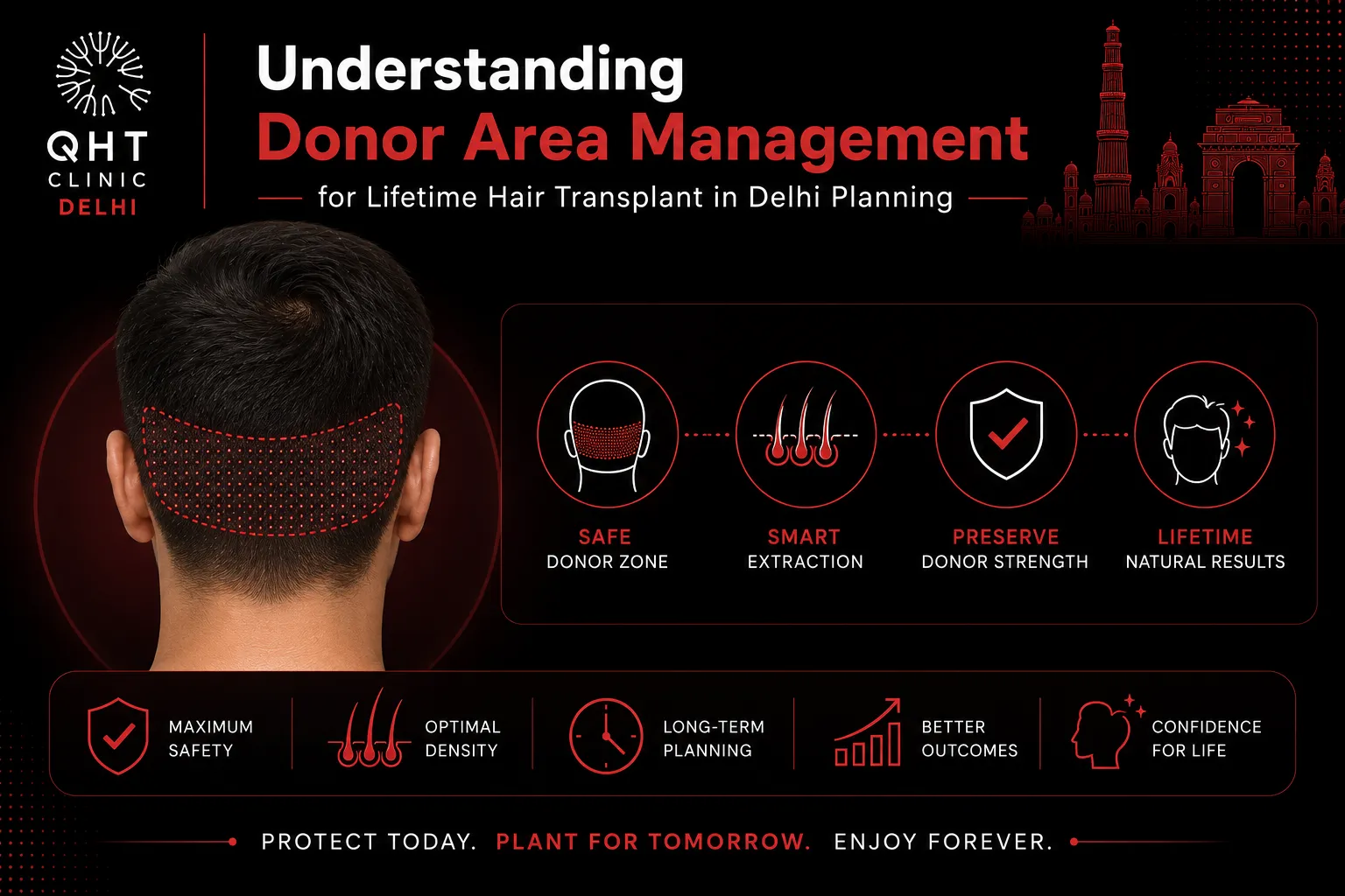 Understanding Donor Area Management for Lifetime Hair Transplant in Delhi Planning