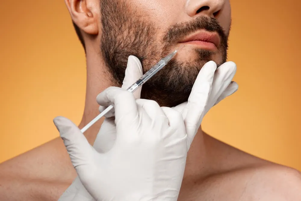 Beard Transplant Bristol: Everything You Need to Know Before Treatment