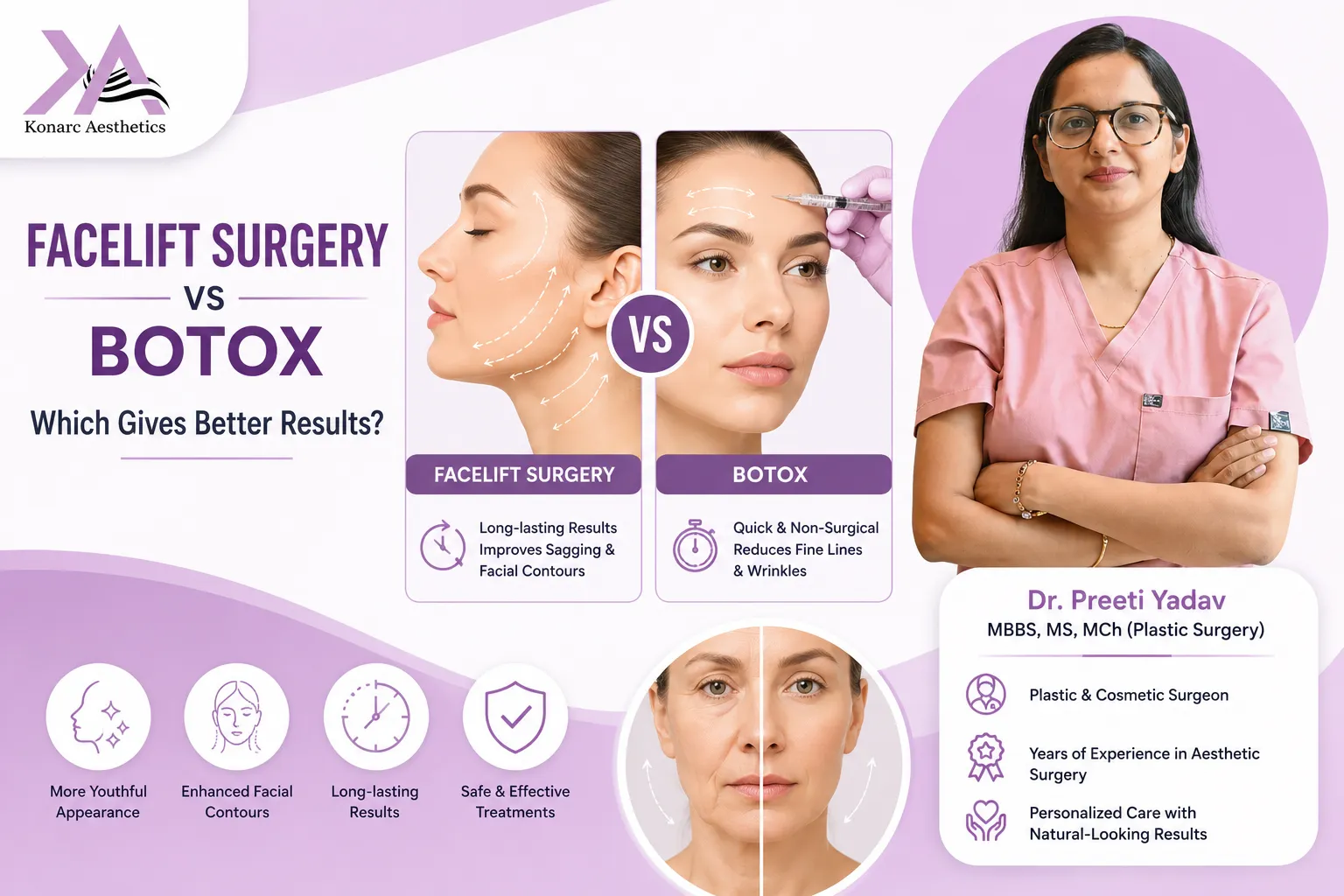 Facelift Surgery vs Botox: Which Gives Better Results?