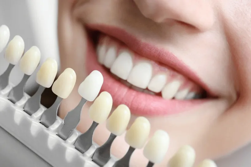 Teeth Whitening San Diego: Common Dental Emergencies You Shouldn't Ignore