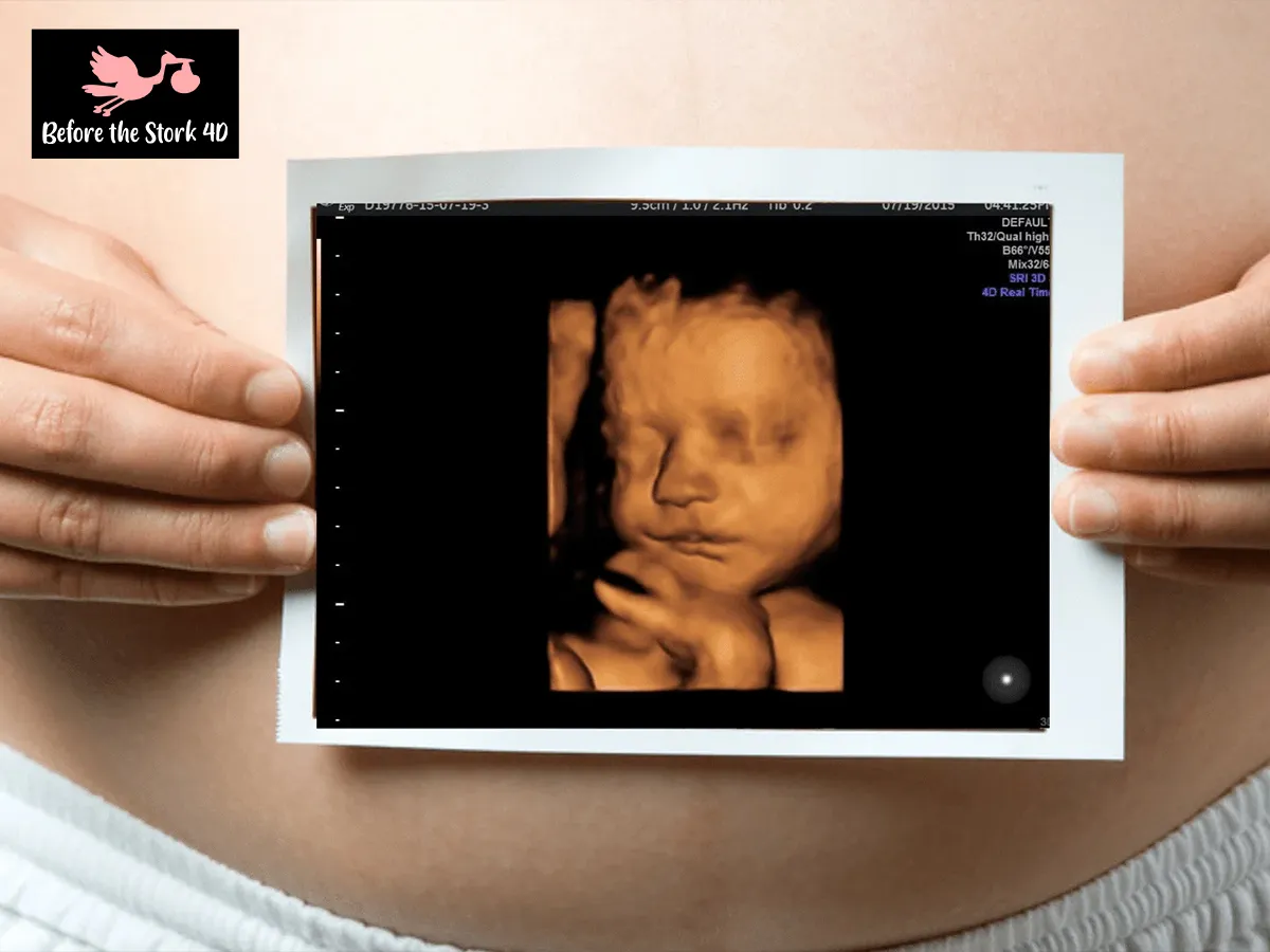 How Early Gender Ultrasound Helps Parents Plan Smarter