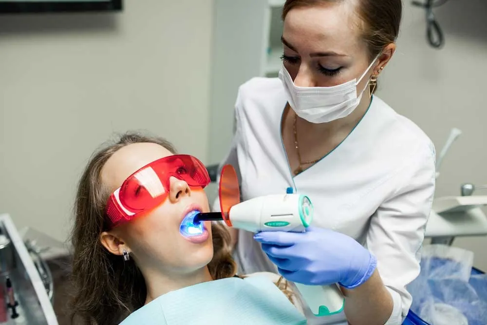 Why Choose Professional Teeth Whitening Over DIY Kits?