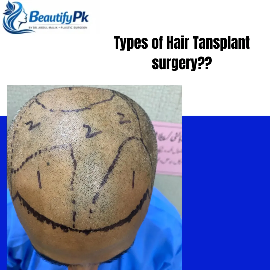 Hair Transplant Surgery Explained: Procedure, Benefits & What to Expect