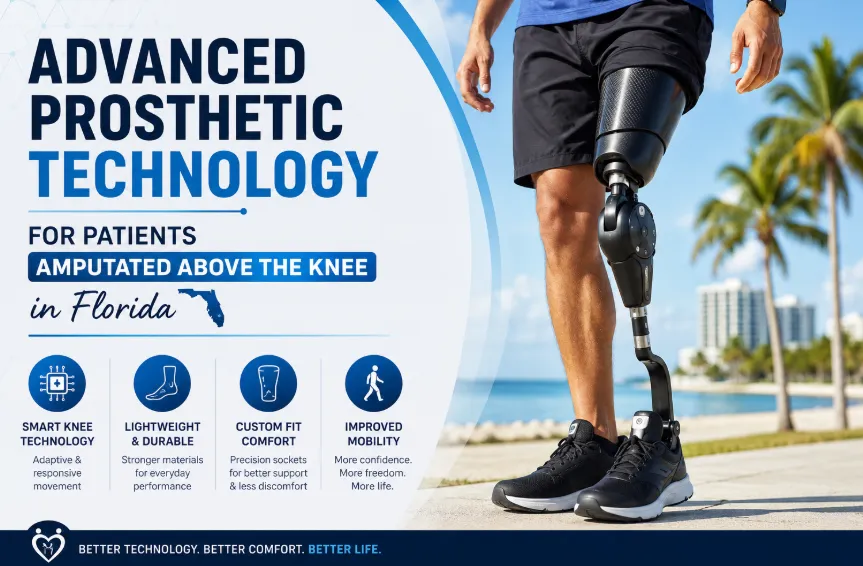 Advanced Prosthetic Technology for Patients Amputated Above the Knee in Florida