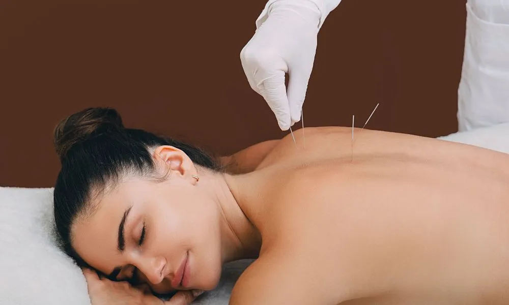 How Acupuncture Supports Mental Health Naturally