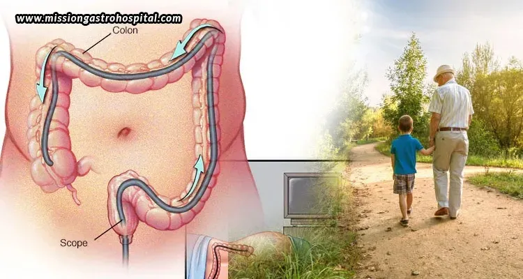 Life After Colonoscopy