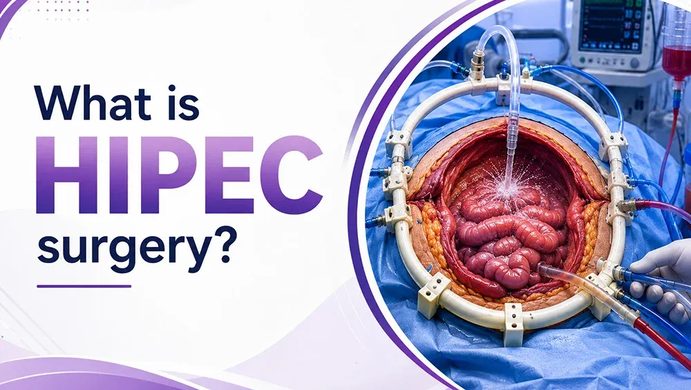 What is HIPEC Surgery? Procedure, Benefits, Risks, and Recovery