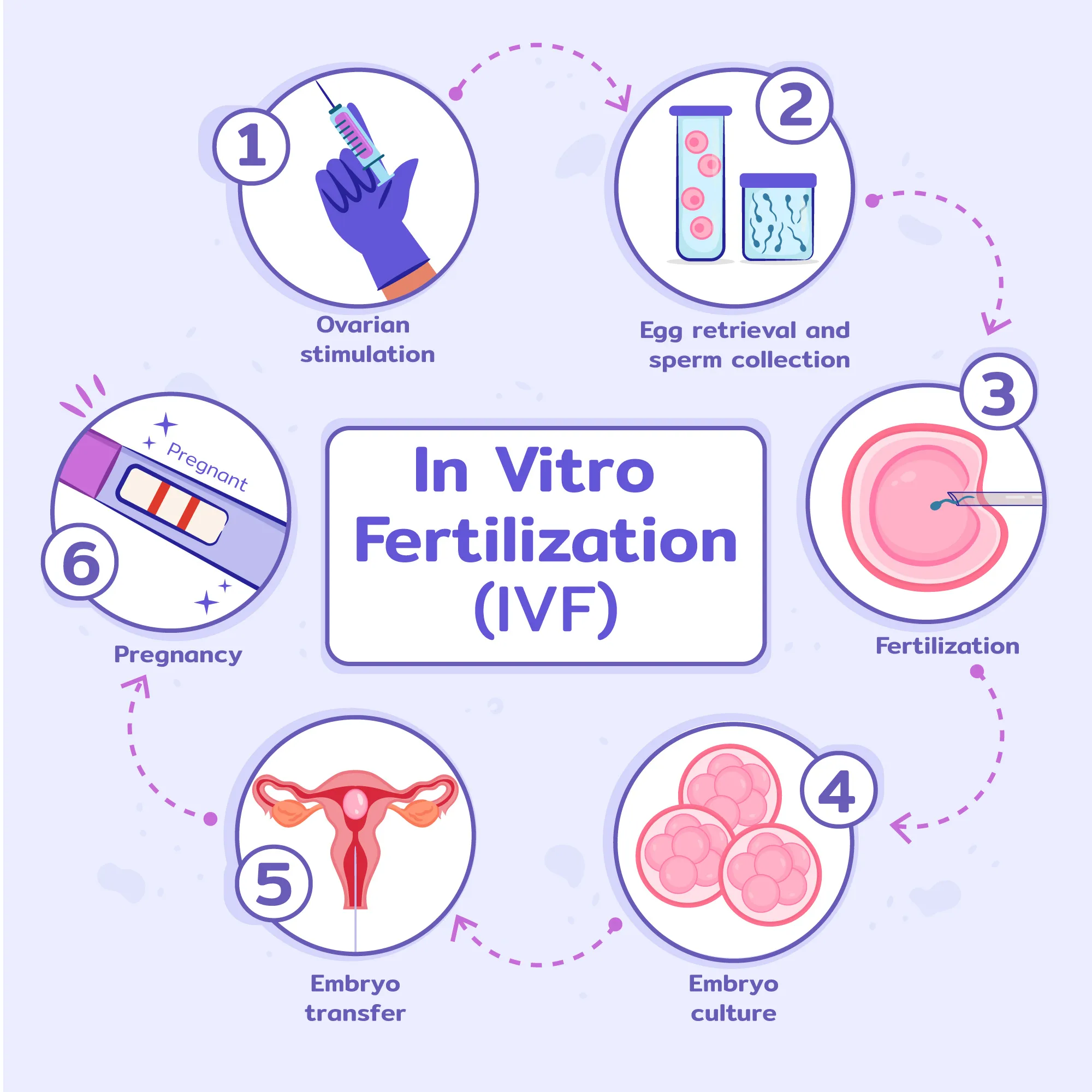 IVF in Los Angeles: 7 Signs It Might Be Time to Consider Treatment