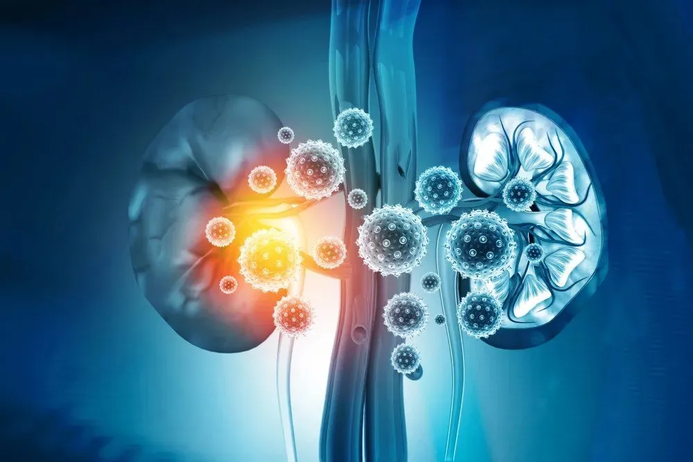 Why Joining an IgA nephropathy Clinical Research Study Could Make a Difference
