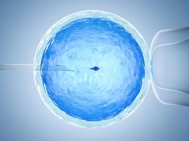 Understanding IUI Cost in Delhi: A Complete Guide for Couples Planning Fertility Treatment