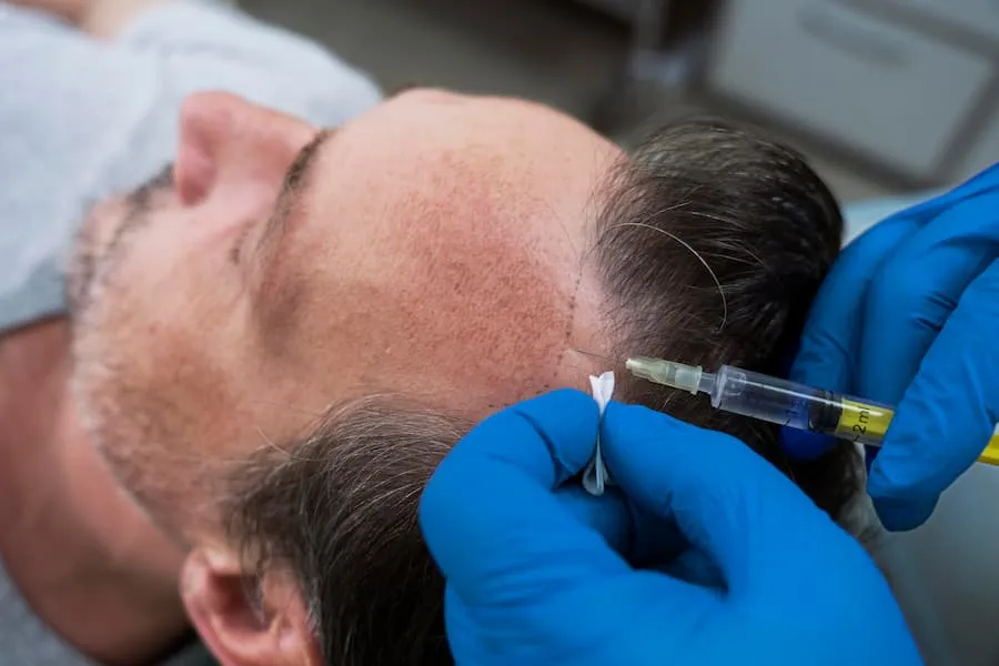 How PRF Hair Treatment Works and What Results Patients Can Expect