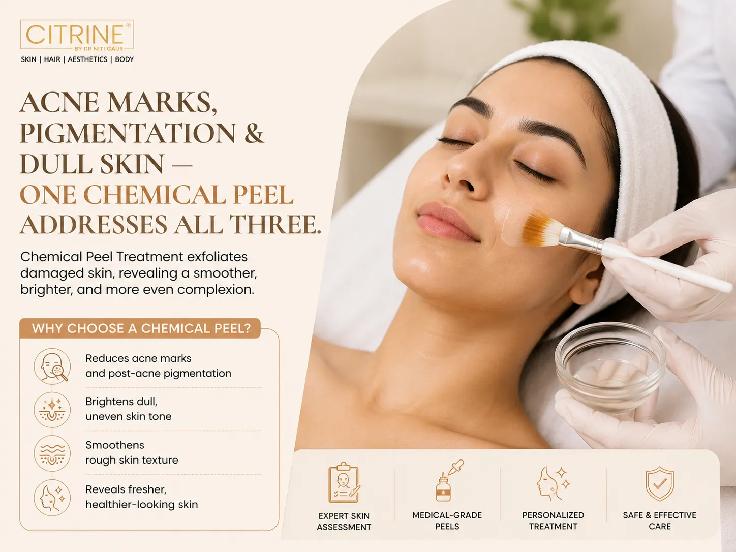 Acne Marks, Pigmentation, Dull Skin — One Chemical Peel Addresses All Three