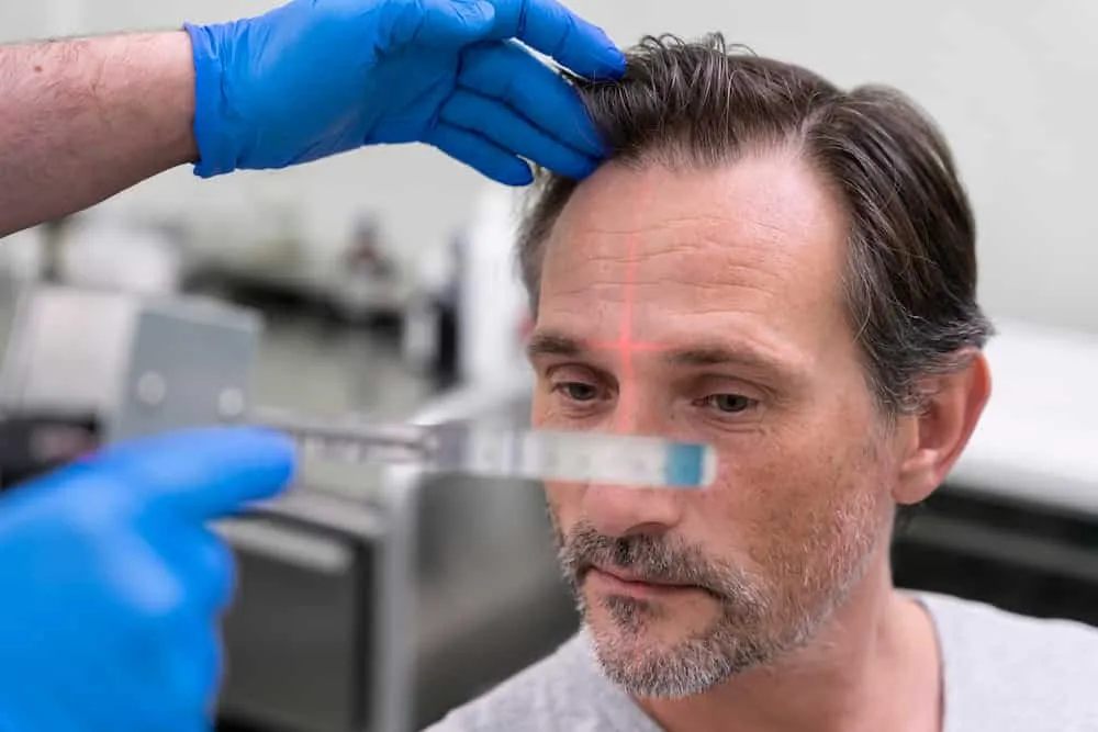The Advantages of Robotic DHI Hair Transplant Cheshire for Hair Restoration