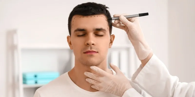 Why Choosing the Right Hair Transplant Clinic Matters