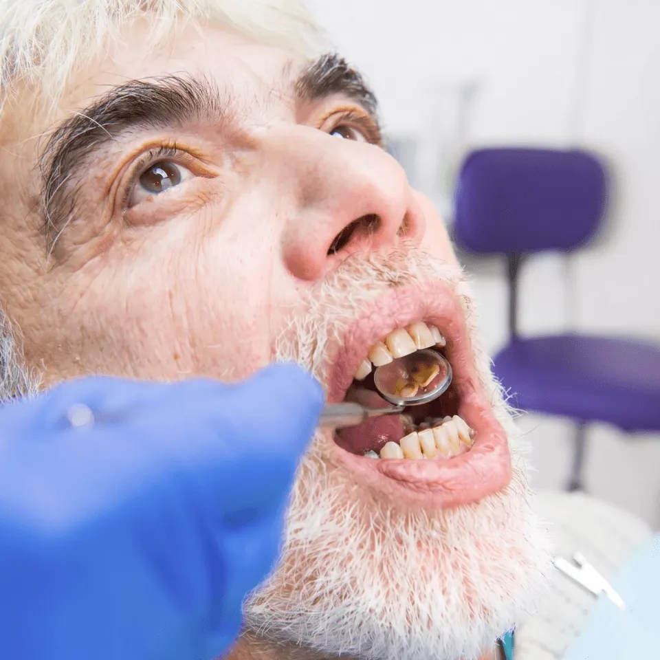 A Practical Guide to Dental Implants in Temecula for Adults 50 and Older
