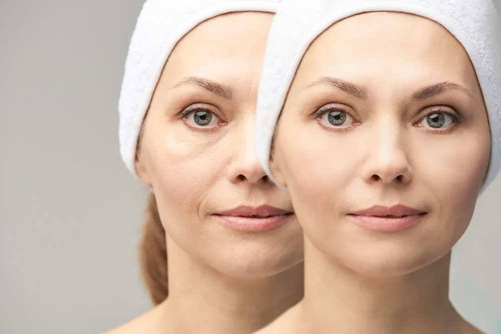 How to Choose Safest Wrinkles Treatment in Baner