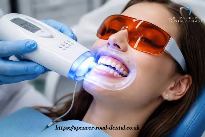 Teeth Whitening Coventry: Safe, Effective Ways to Brighten Your Smile