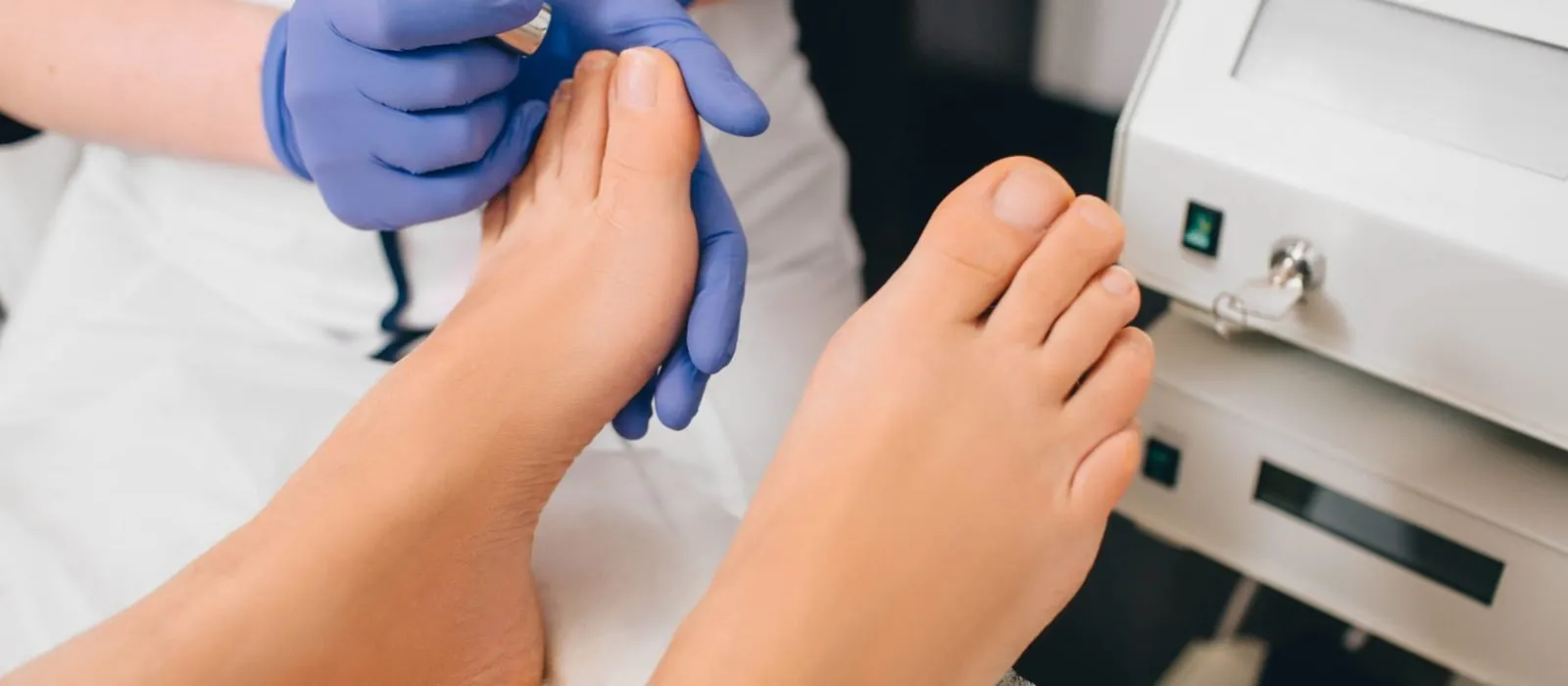 Why Dermatologists Excel at Nail Fungus Treatment and Relief