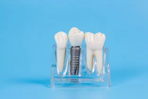 Long Term Tooth Replacement with dental implants burton upon trent Experts