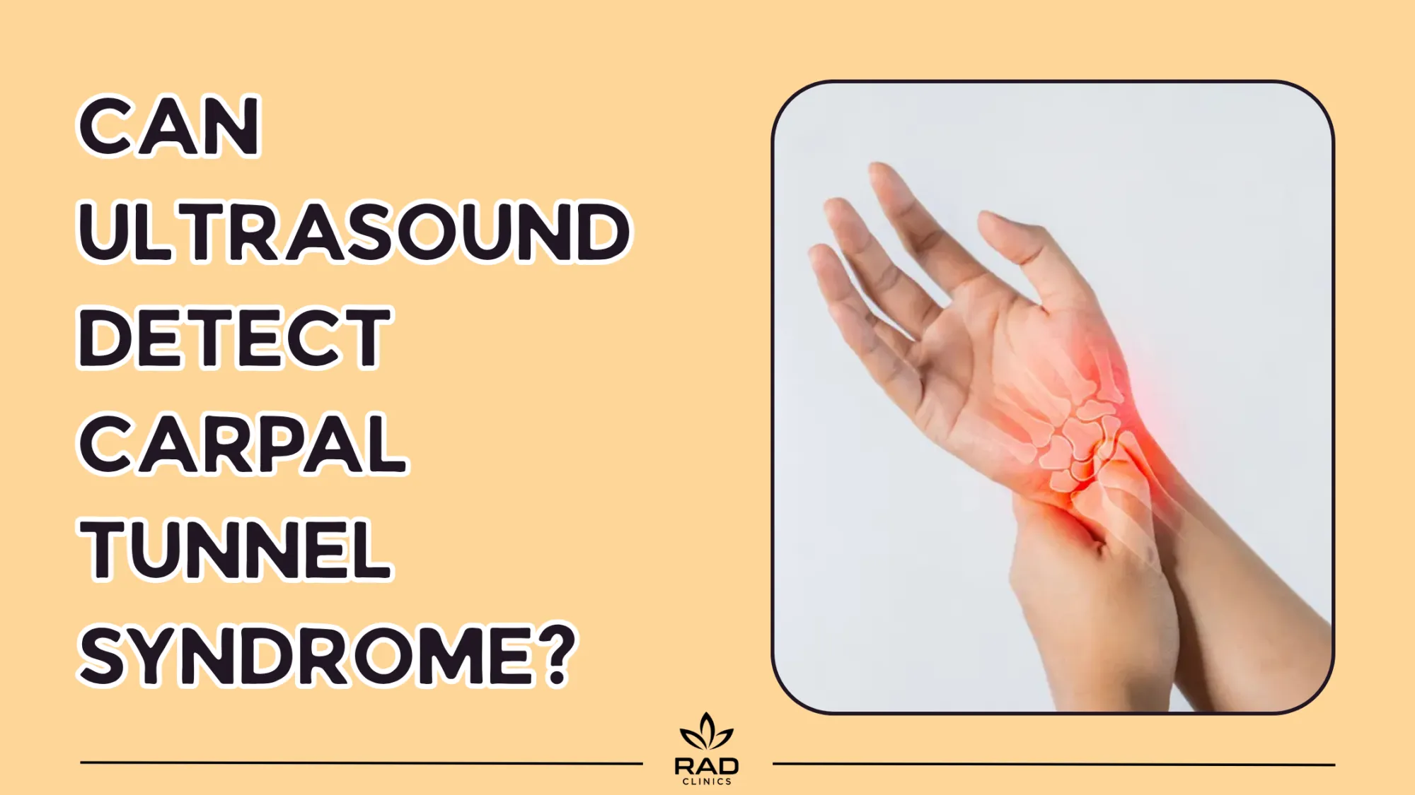 Can Ultrasound Detect Carpal Tunnel Syndrome? What the Evidence Shows