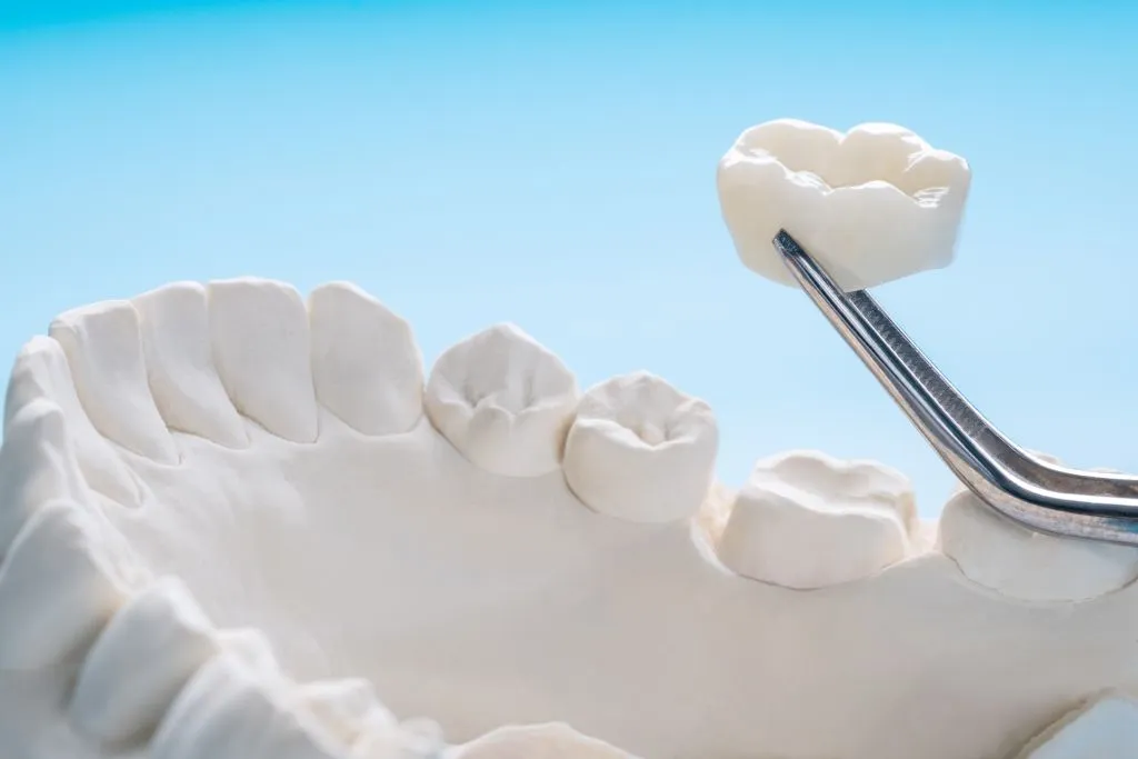 The Complete Guide to Dental Crowns: Restoring Your Smile’s Strength and Beauty