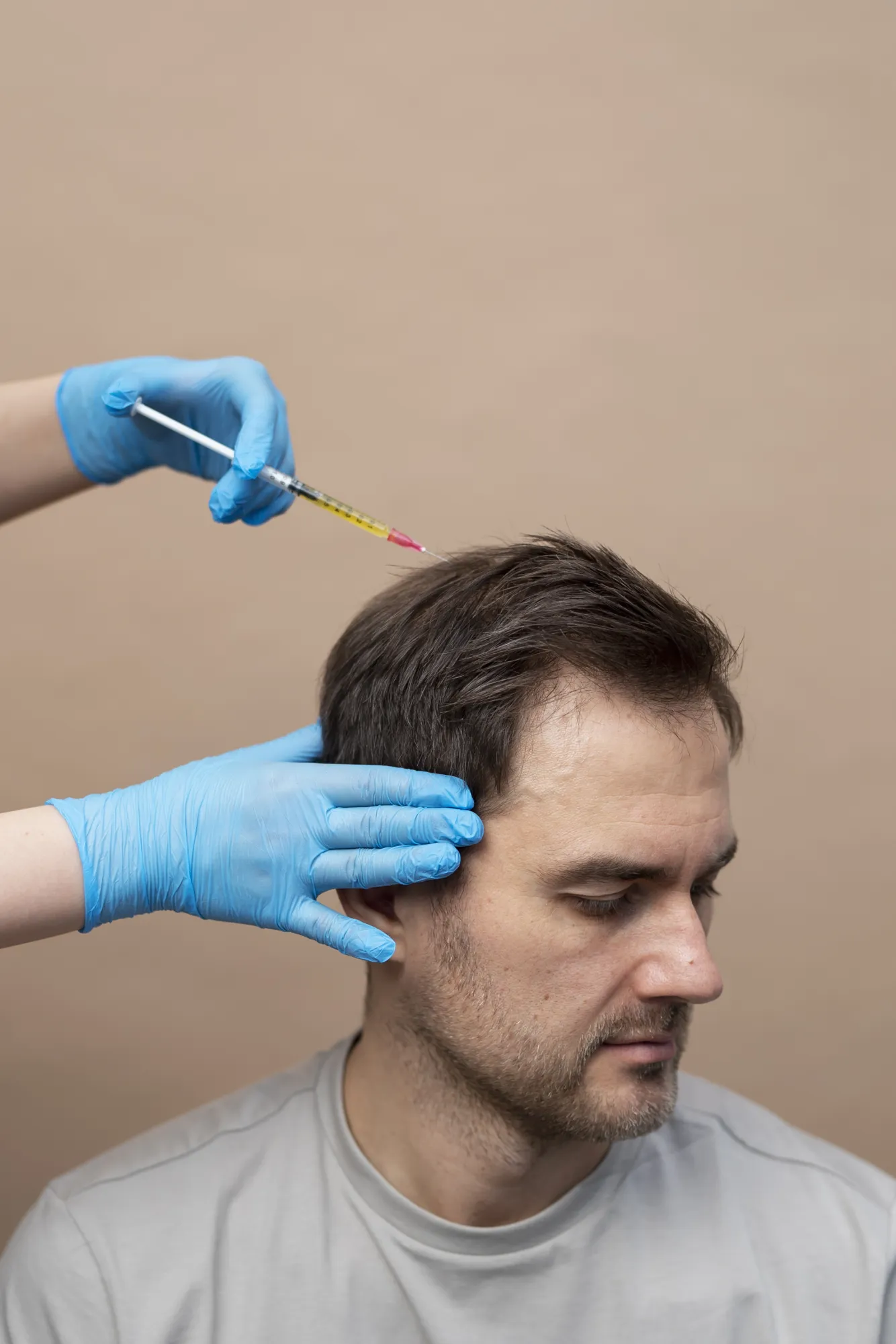 Top Hair Transplant Clinic in Delhi: How to Choose the Best Clinic for Natural Results (2026 Guide)