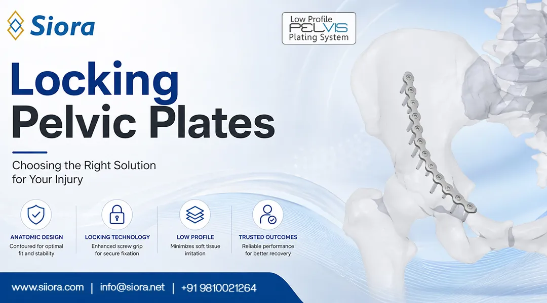Locking Pelvic Plates: Choosing the Right Solution for Your Injury